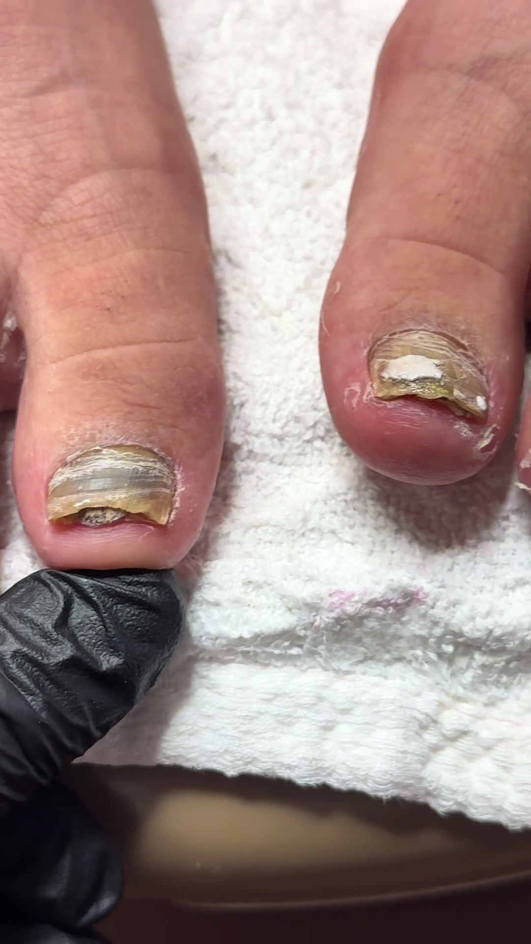 @ToesbyKoki