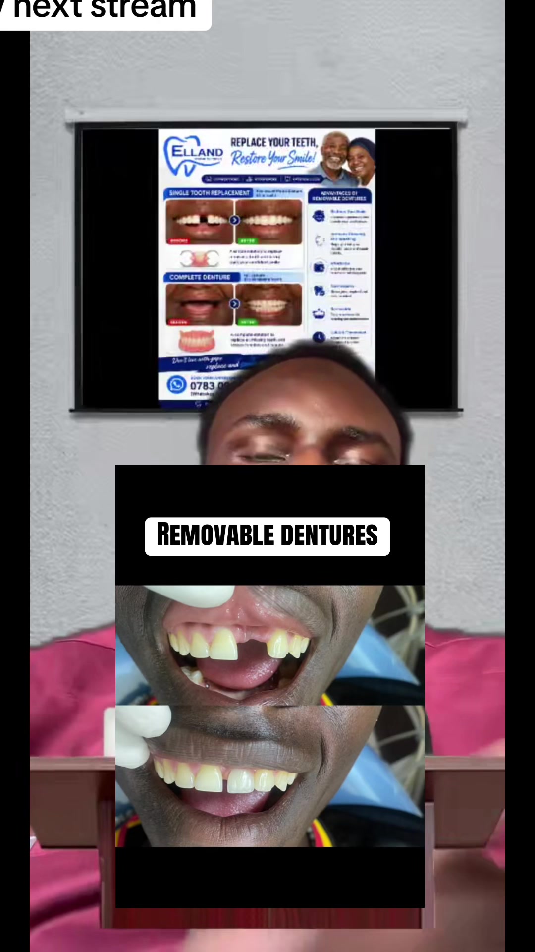 @Dr~MUJUNI 🦷🇺🇬✅
