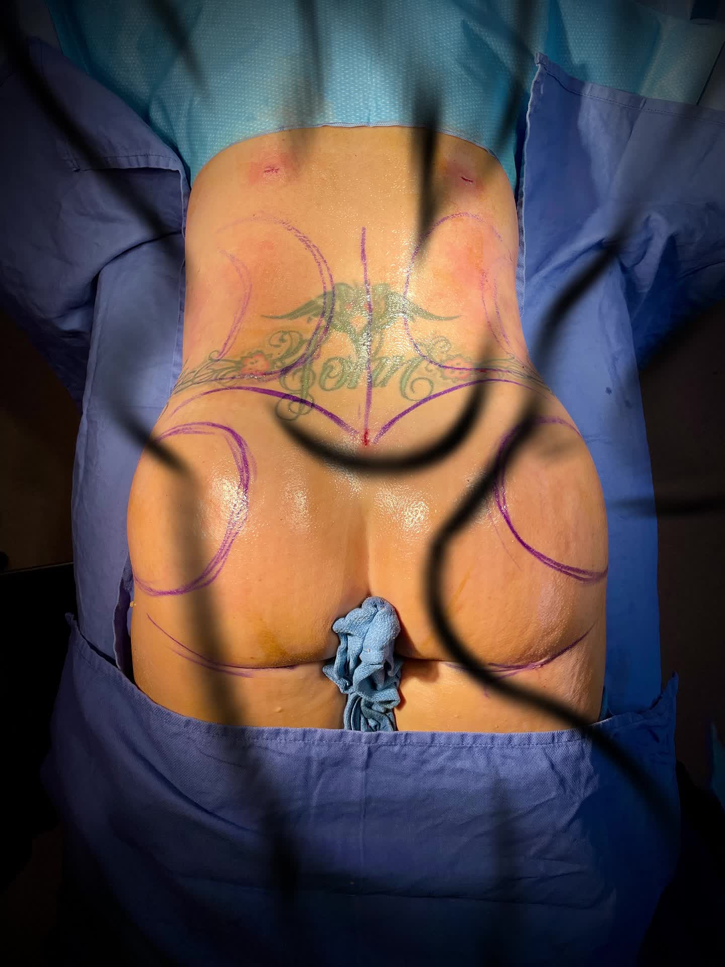 @suncoastplasticsurgery