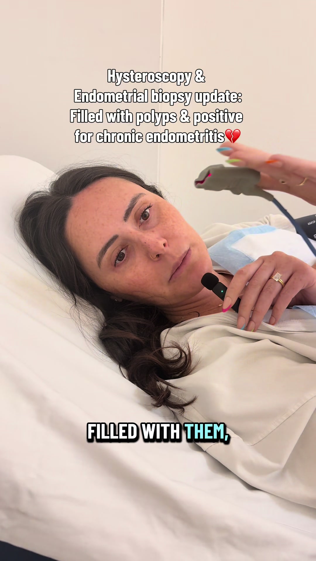 @Paigey &bull; Reciprocal IVF