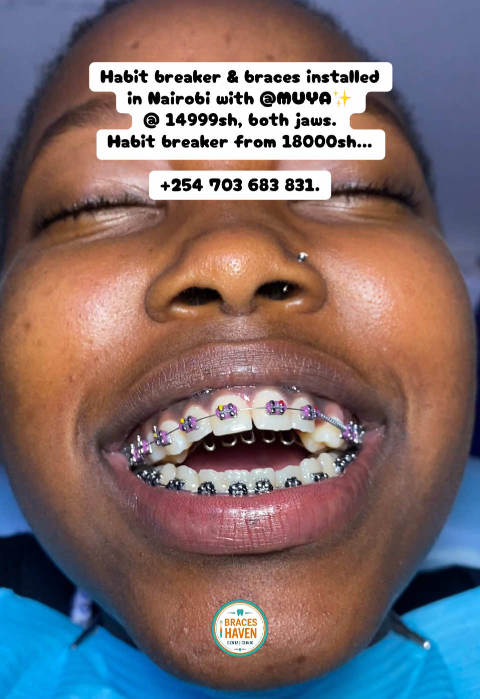 @Braces Haven Nairobi Dental