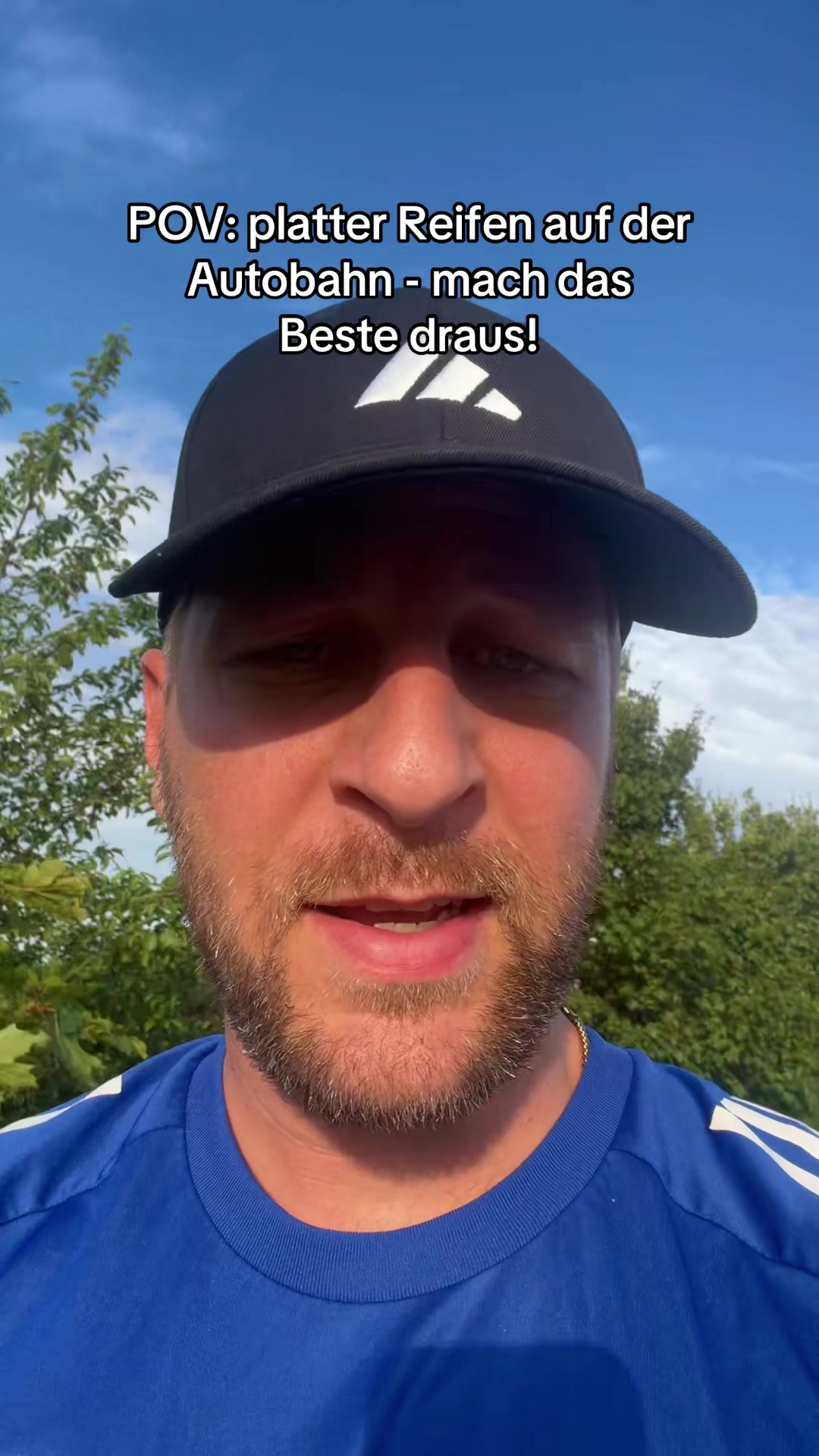 @Mr. Hairtransplant
