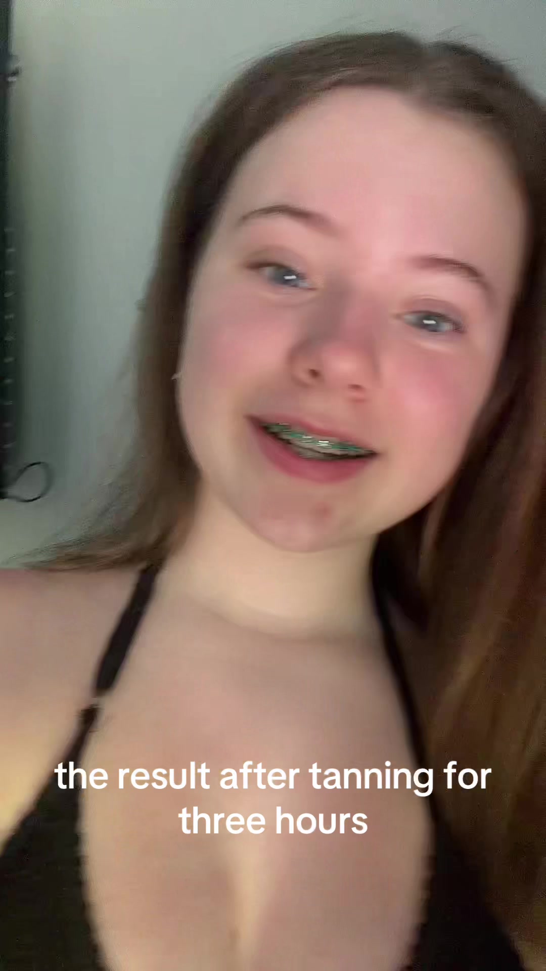 @NOELLA