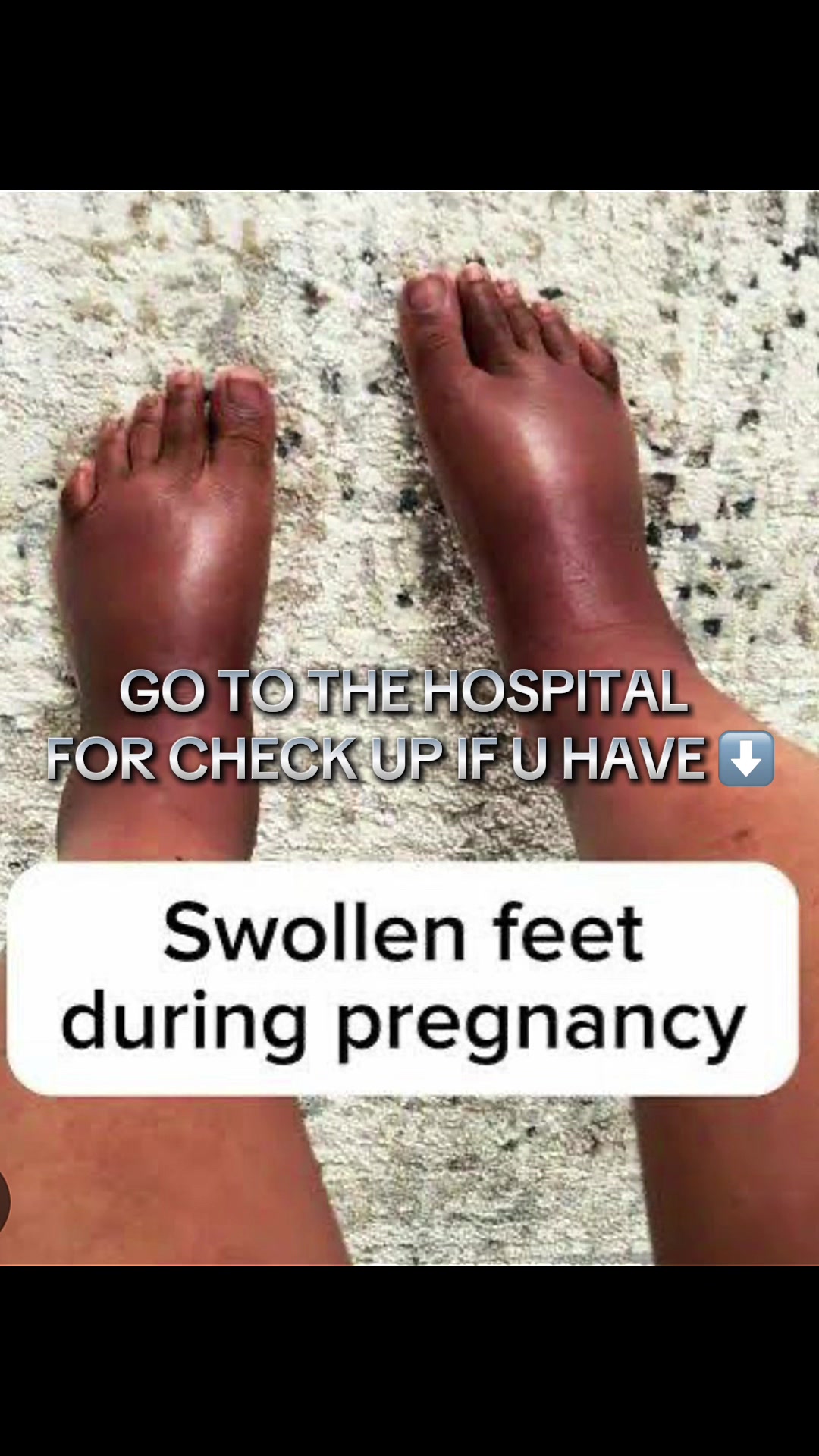 @Shamsa _Midwife 👩⚕️🩺💉