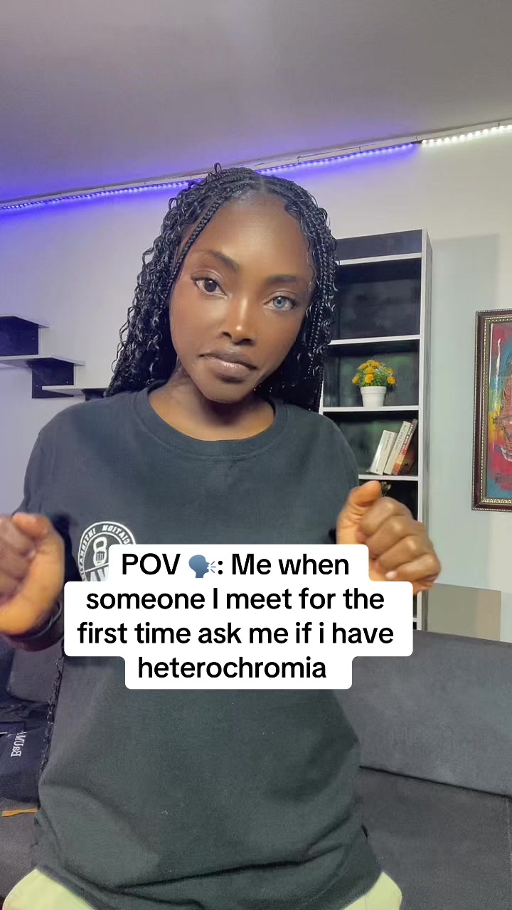 @Nana with Heterochromia