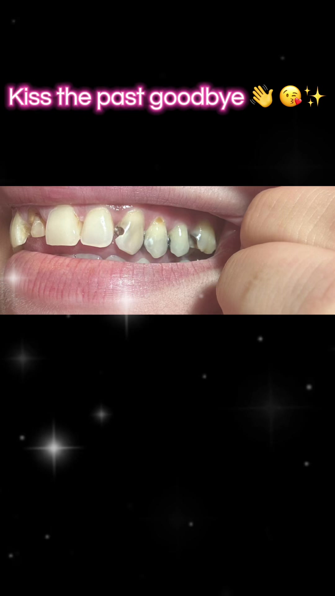 @TruthInMyTeeth