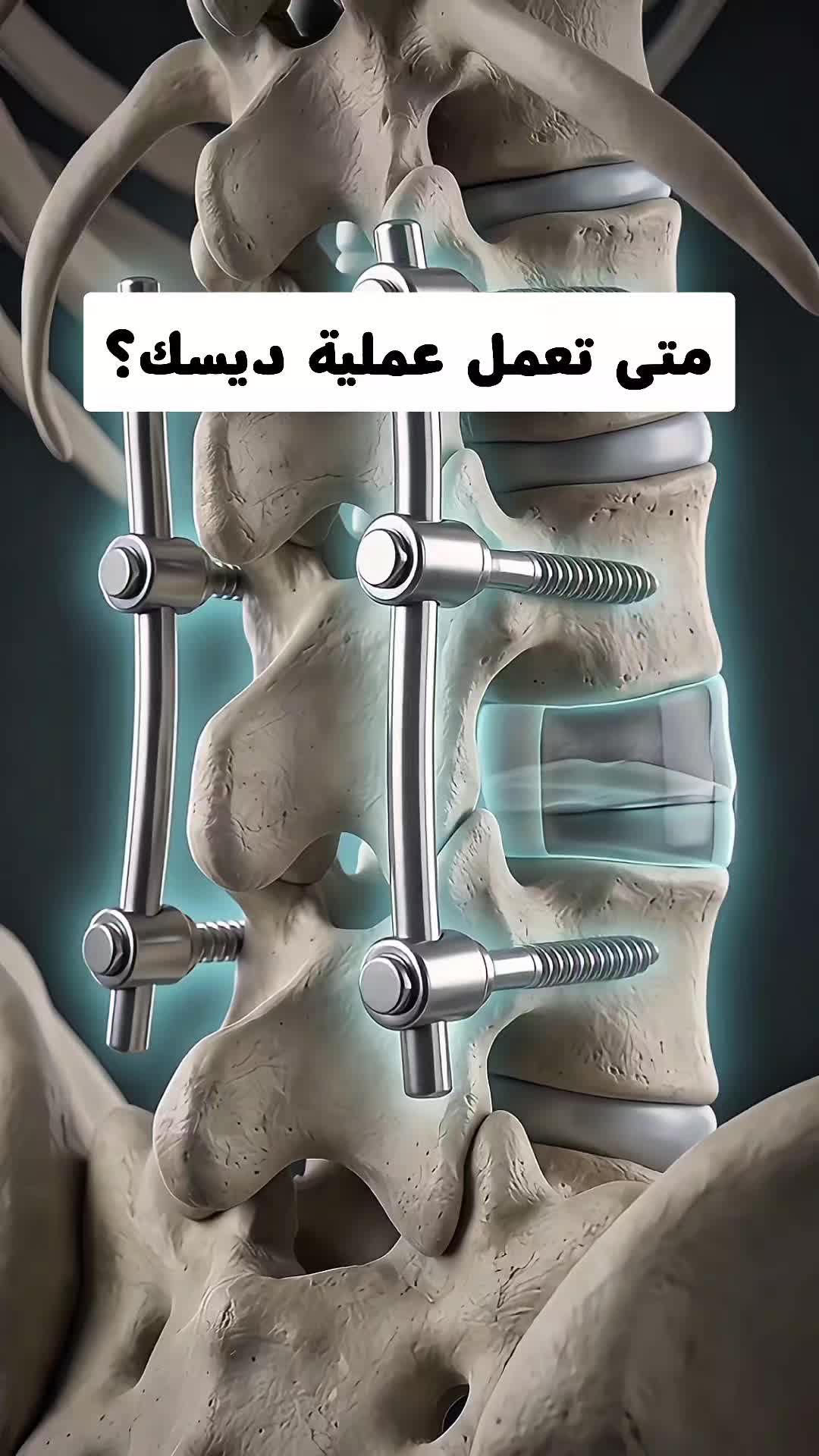 @BasharFlex