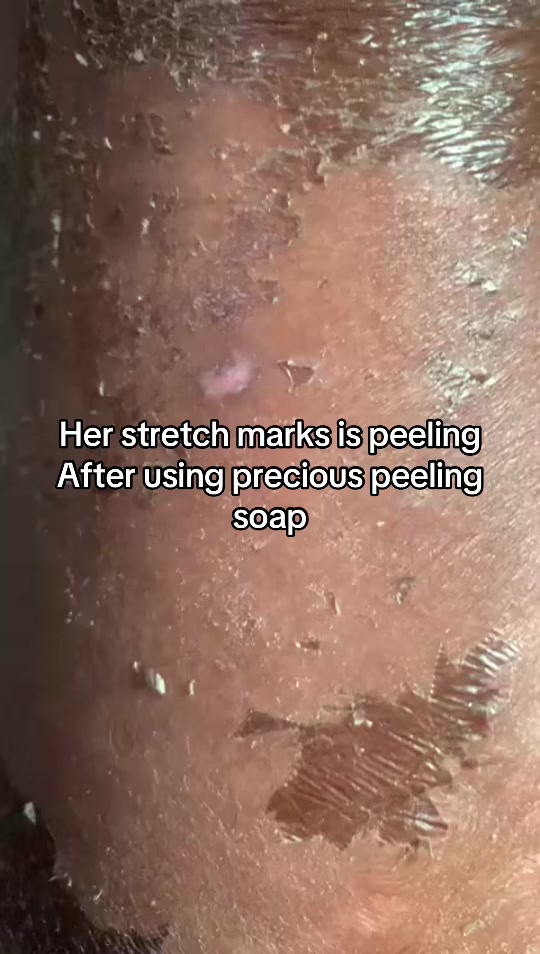 @@ Precious peeling soap
