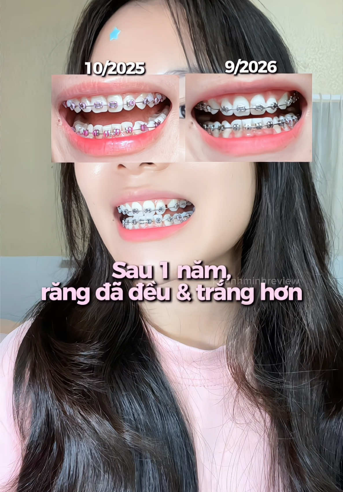 @khanhminhreview