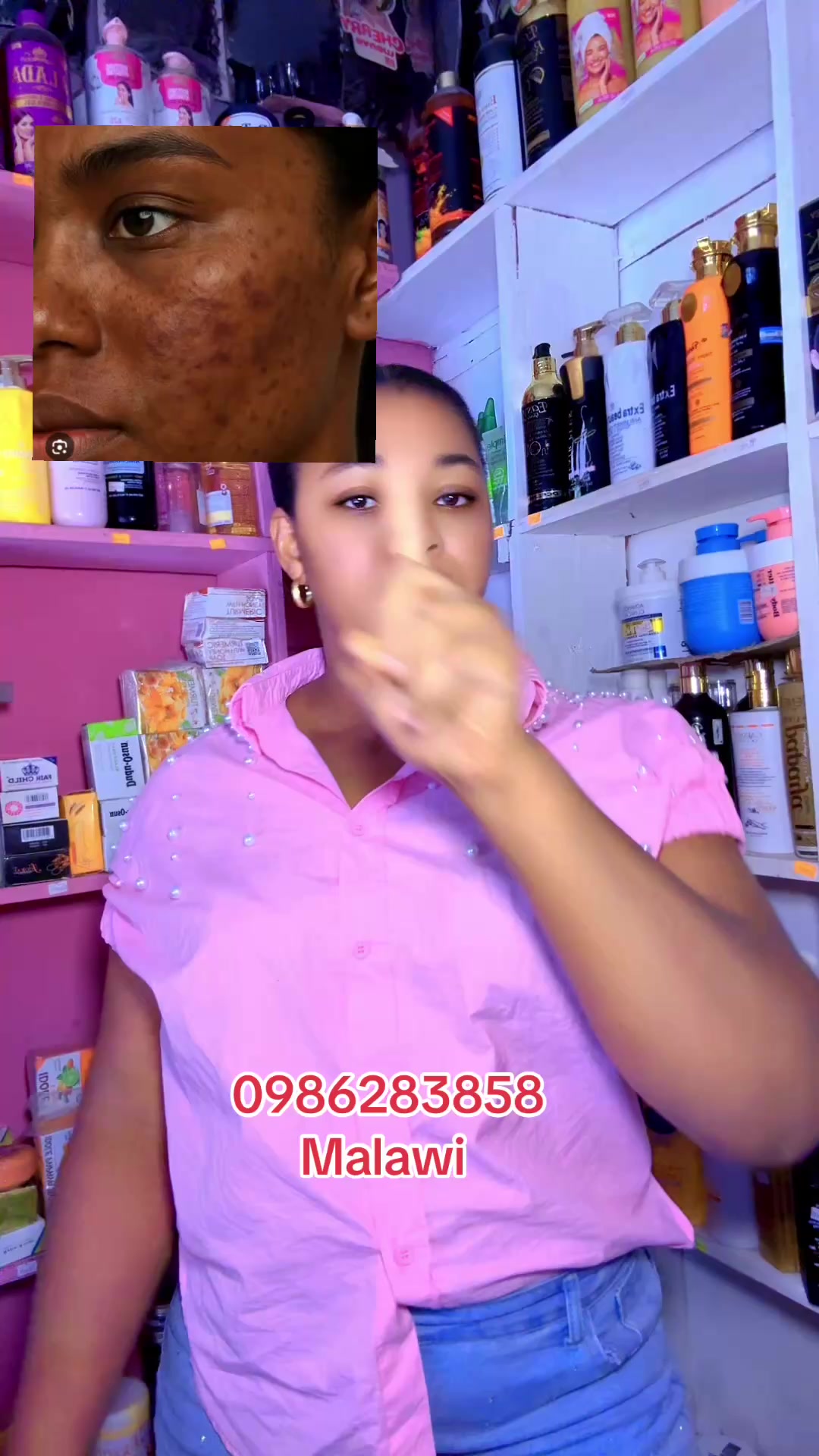 @Chilax_beautycosmetic Malawi