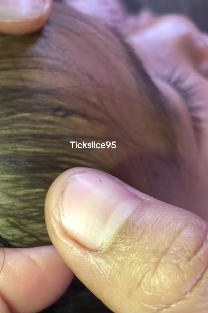 @Tickslice95