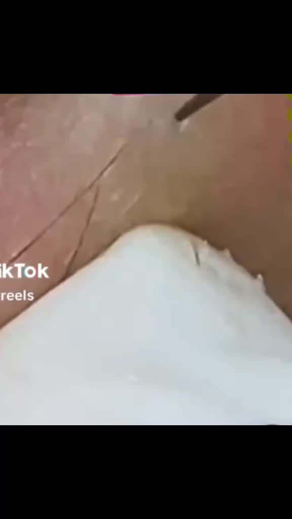 @Antonella Tarozzo