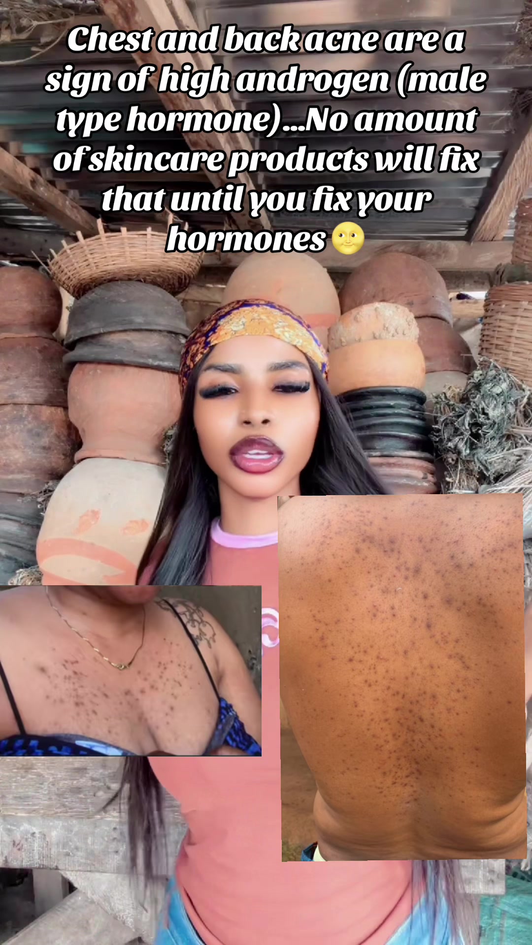 @GeNz_alagbo🐍🍯