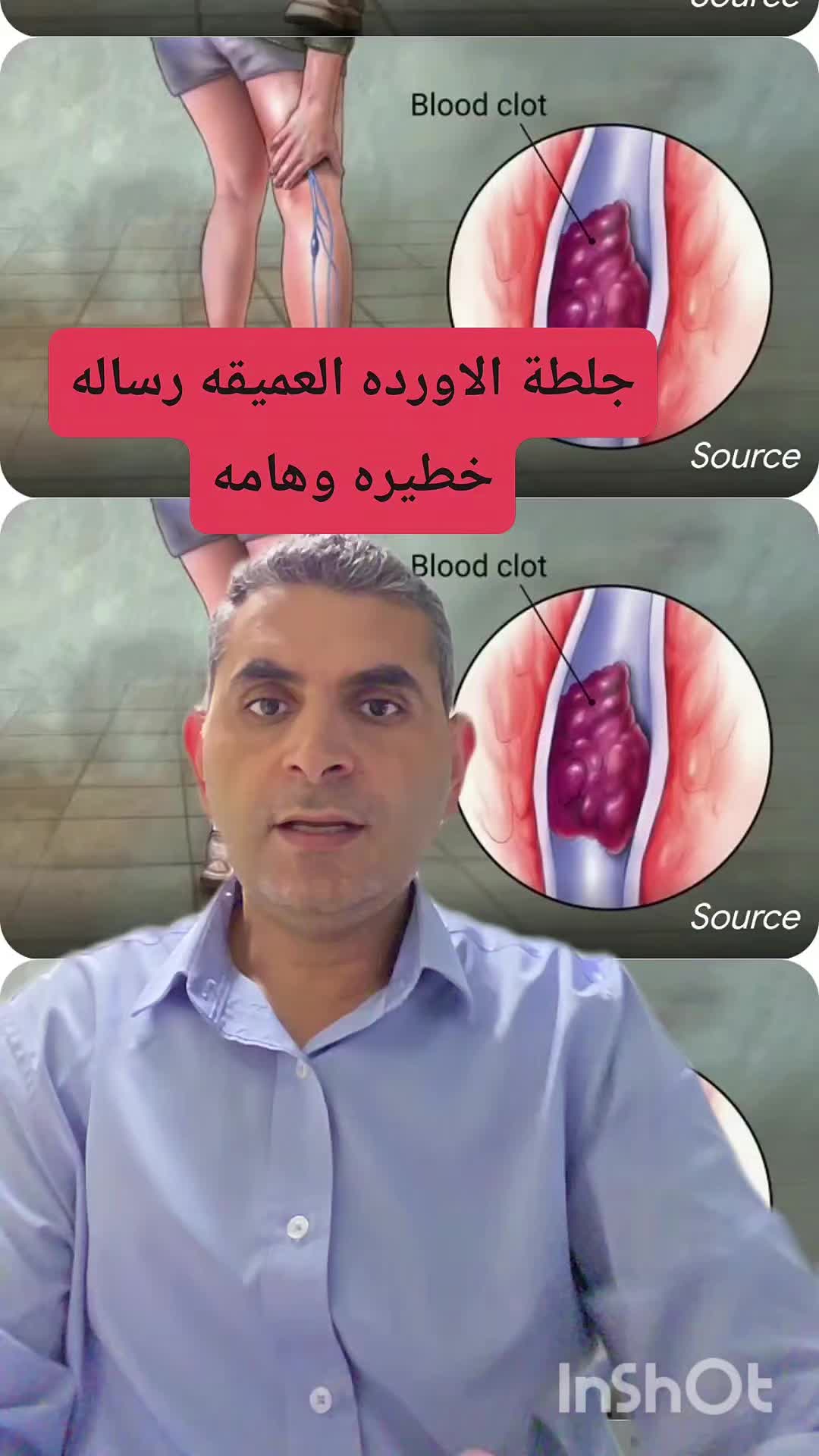 @Dr. Waleed Attia