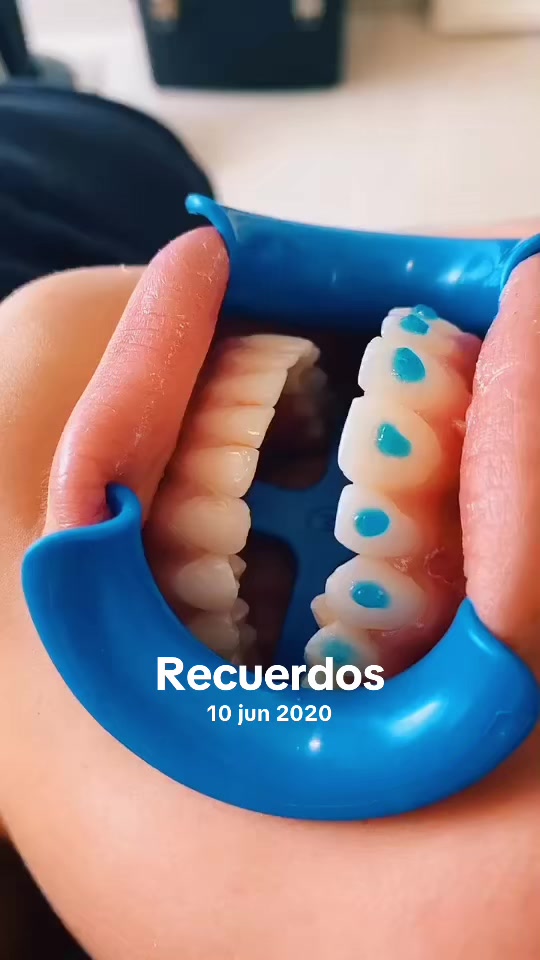 @mayesoficial 🦷🪥