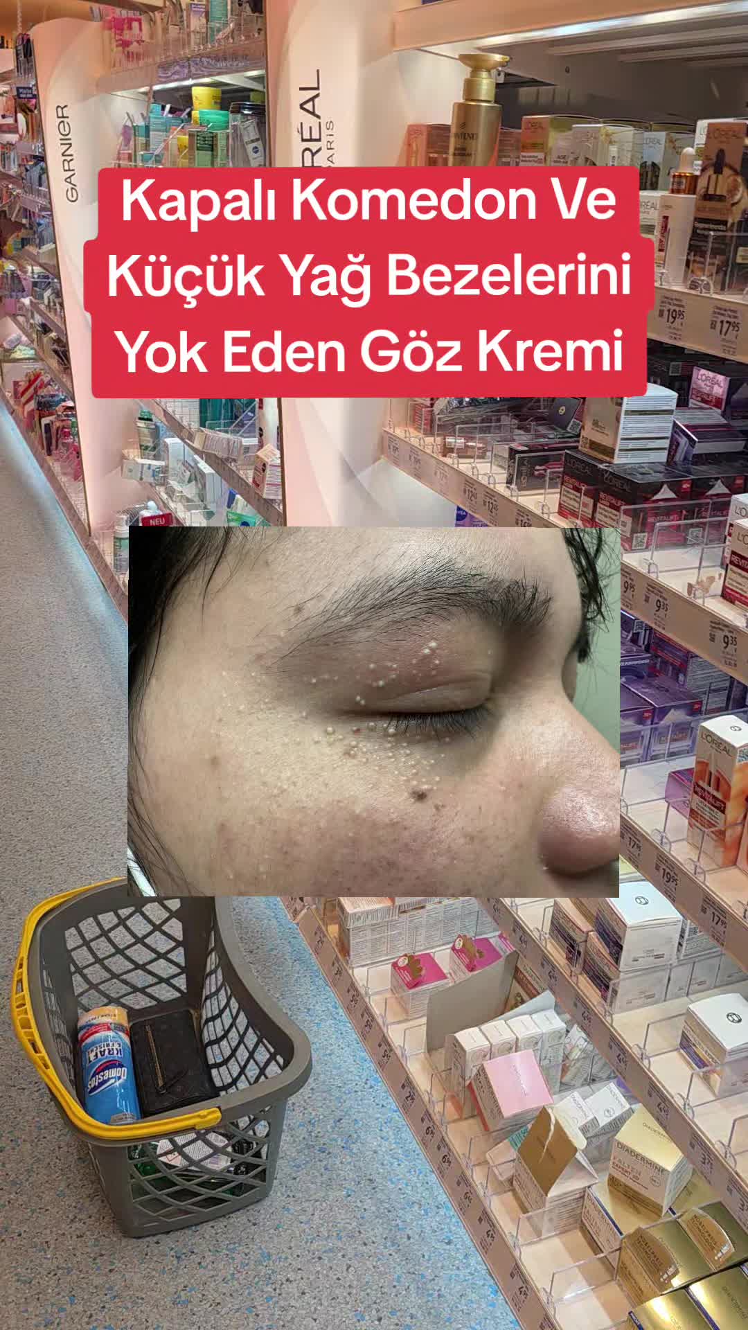 @Gurbetana27