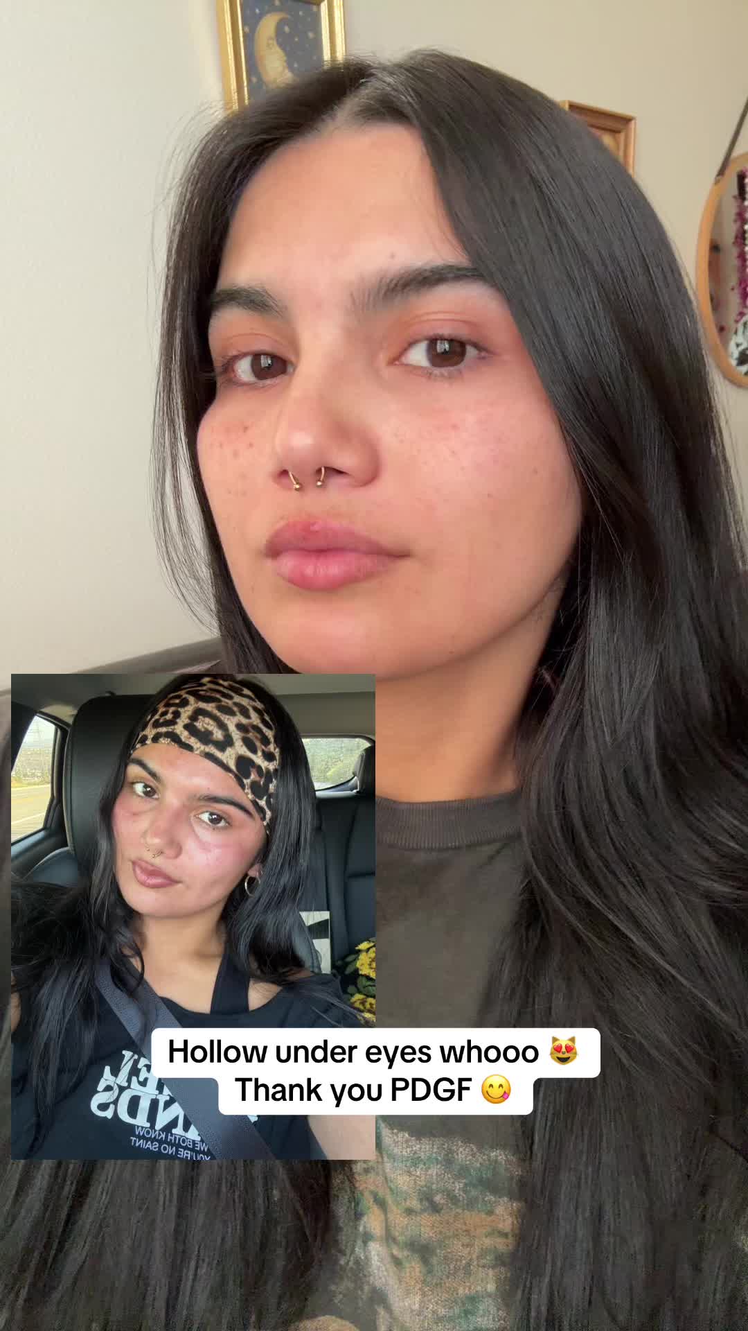 @Aowie