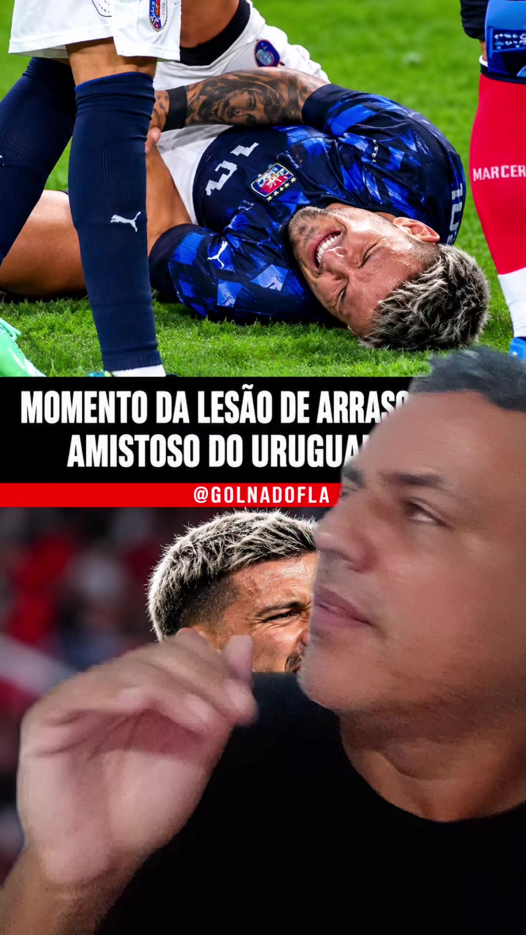@Coxitro