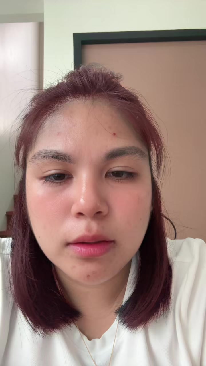 @Yen