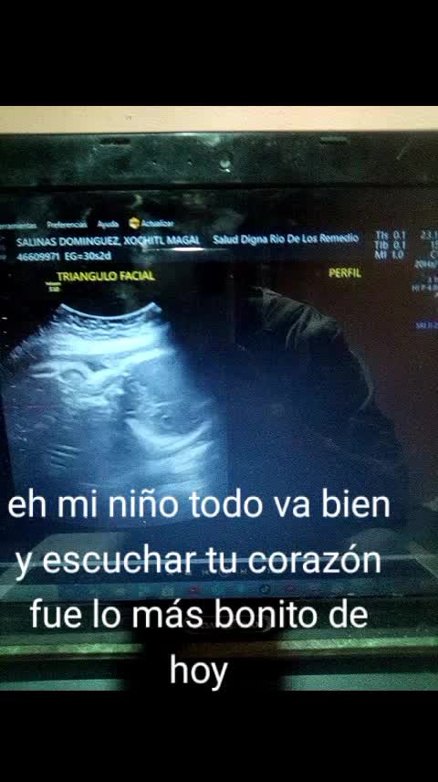 @chikitadominguez ๐ฅฐ๐ฅฐ๐