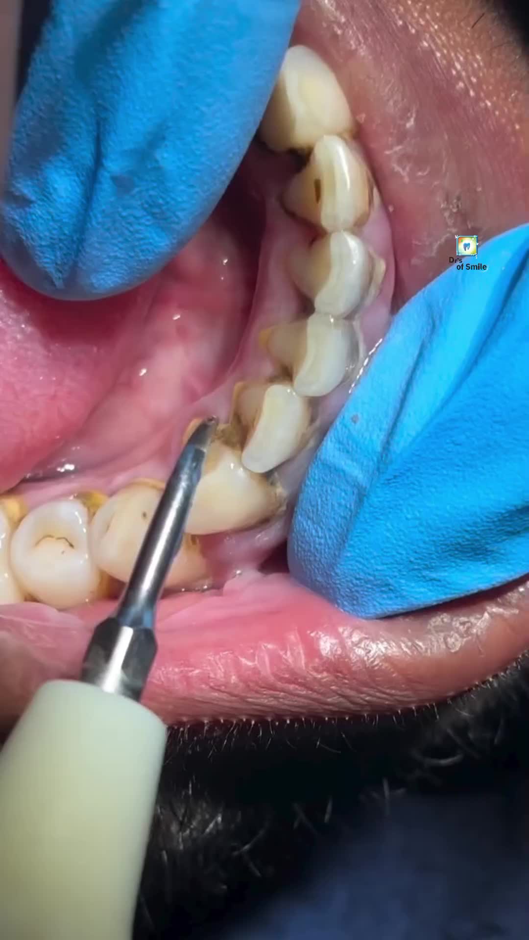 @𝗗𝗿'𝘀 𝗢𝗳 𝗦𝗺𝗶𝗹𝗲🦷🧑⚕️