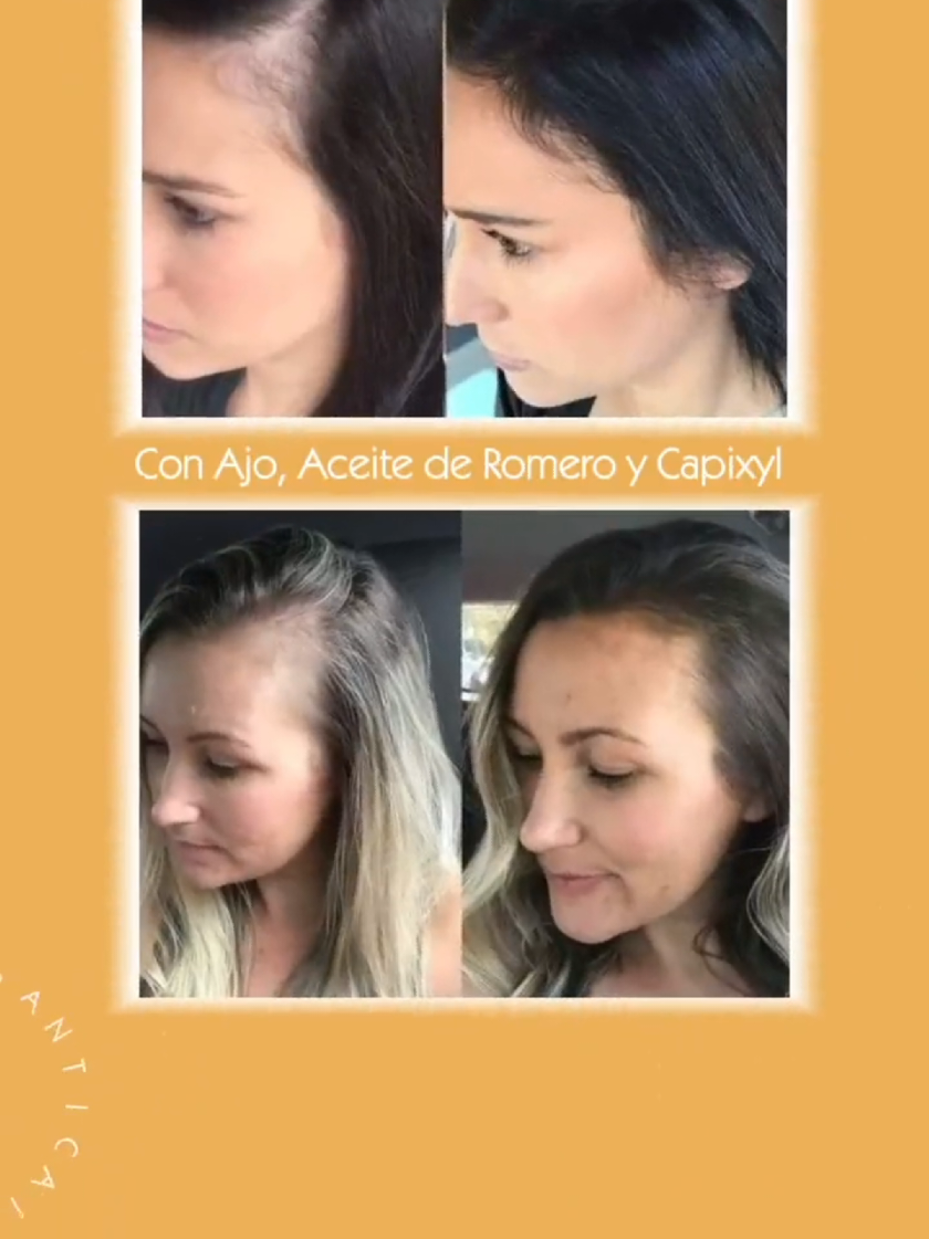 @ANGELICA-BIENESTAR-ISSANPLUS