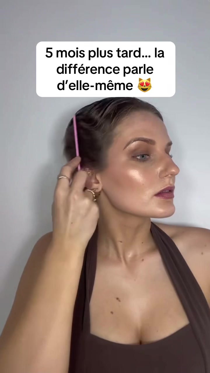 @Lux&rsquo;Hair Growth