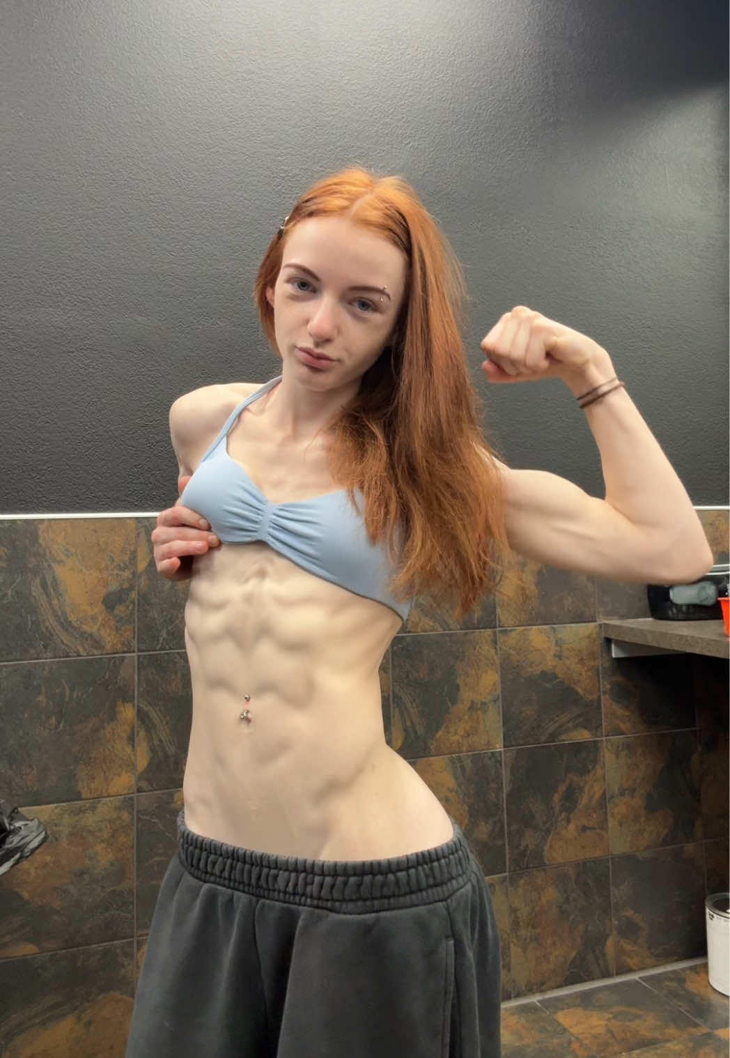 @abi