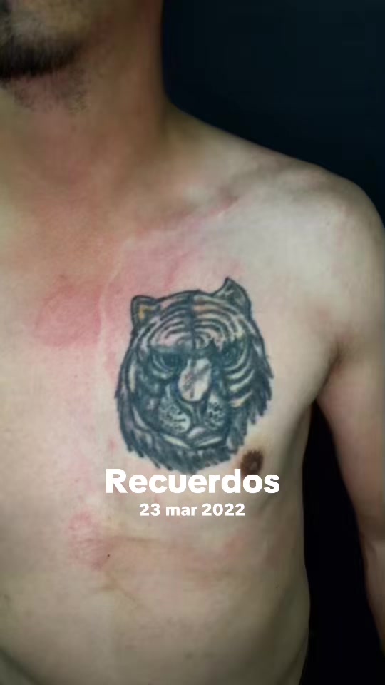@Mauro Scorpions