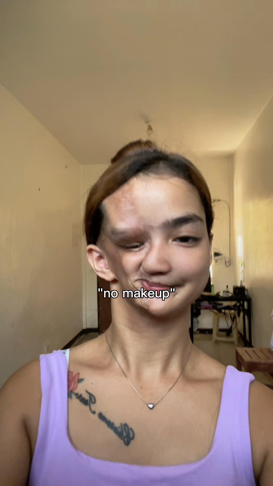 @Charene Treso