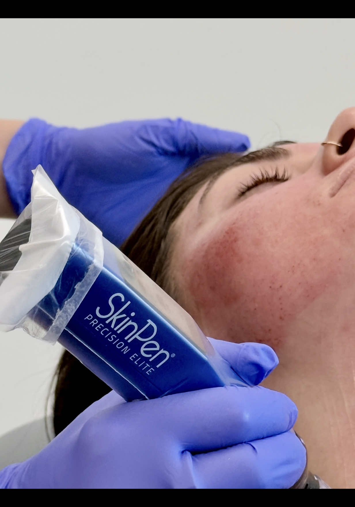 @Smith Facial Plastics