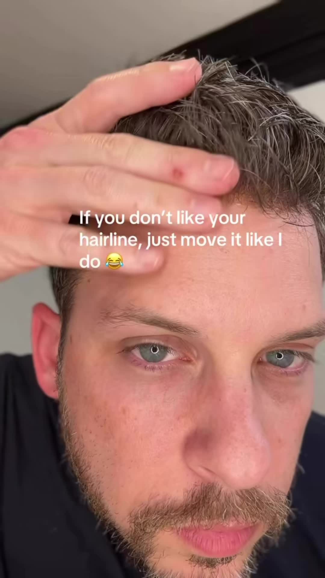@Jared Has Hair