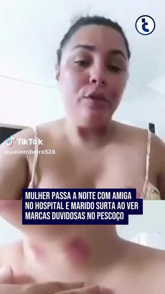 @Silva Rodrigo