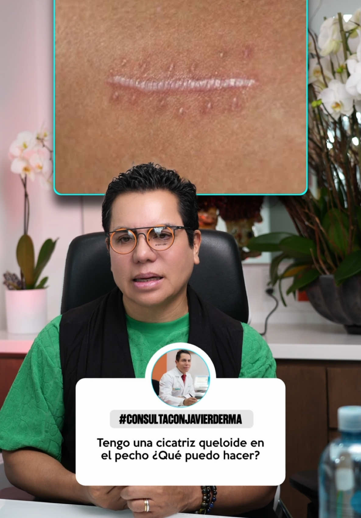 @JavierDerma