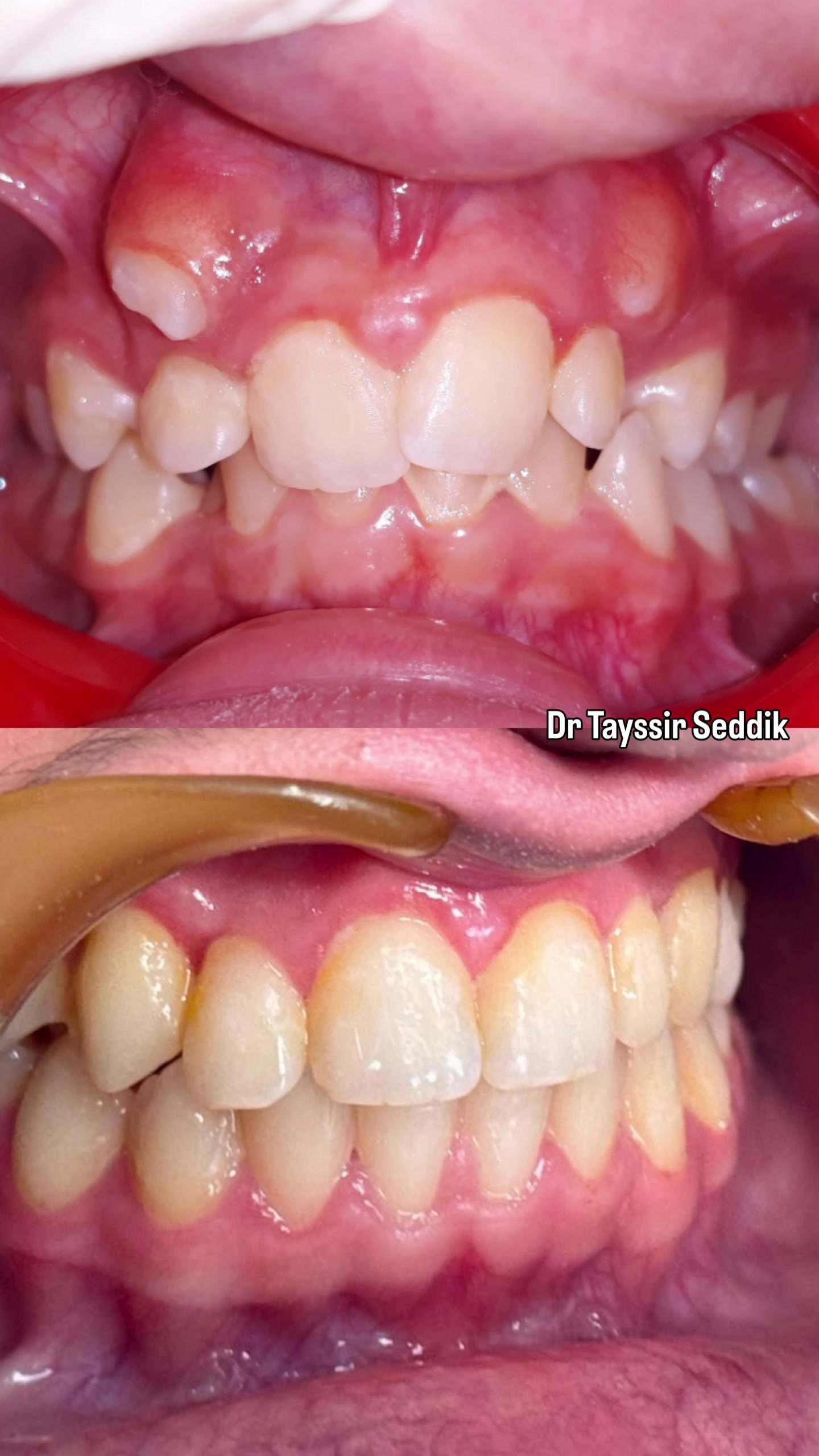 @Dr Tayssir Seddik