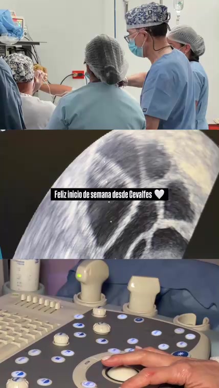 @Cevalfes