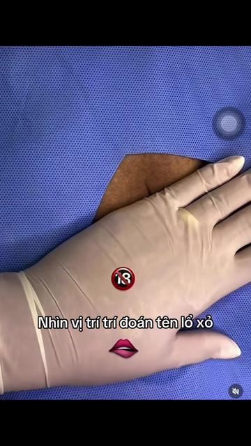 @Xỏ khuyên-ToothGems Vũng Tàu