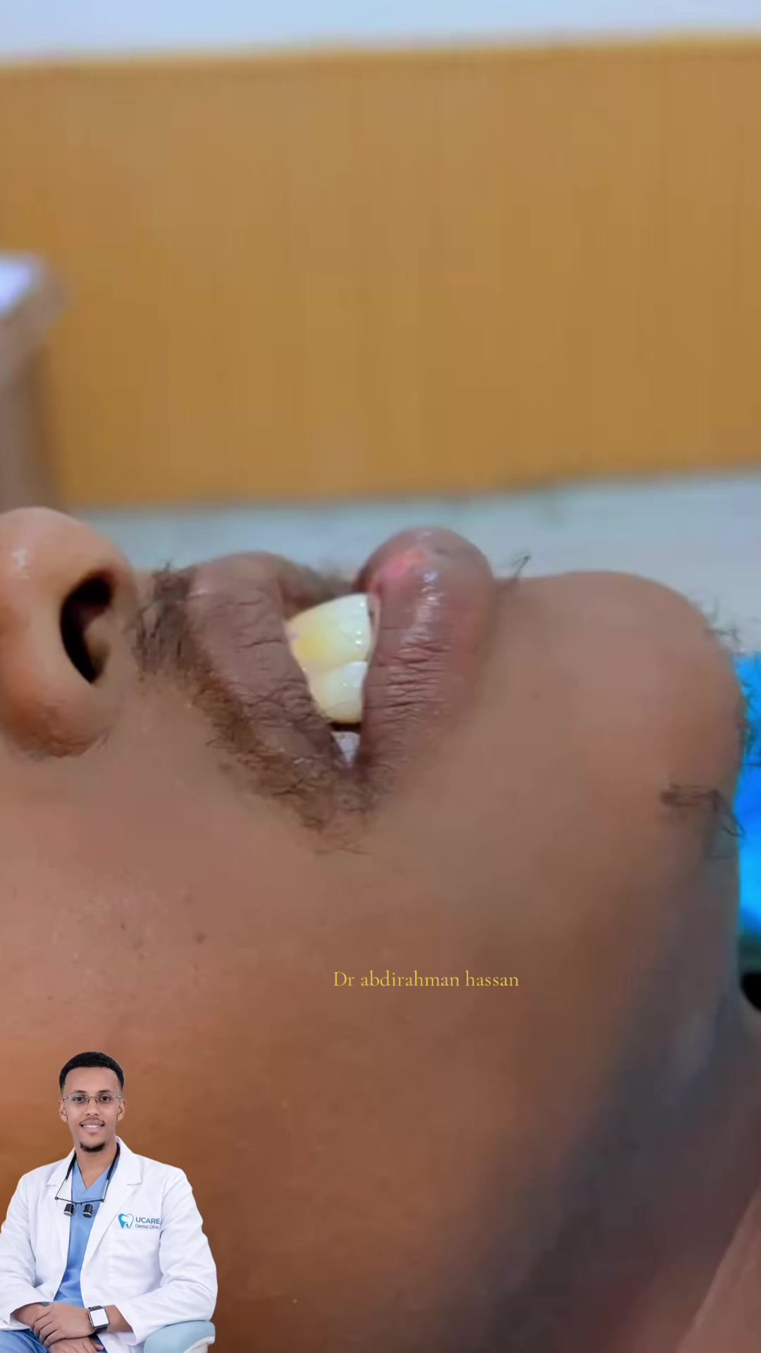 @Dr Abdirahman hassan laari