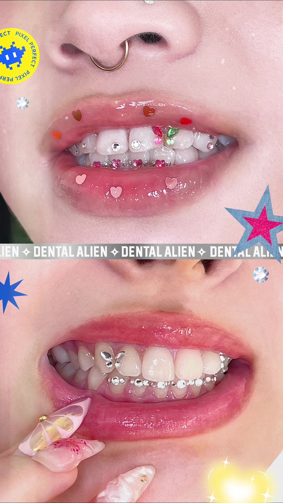 @DENTAL ALIEN
