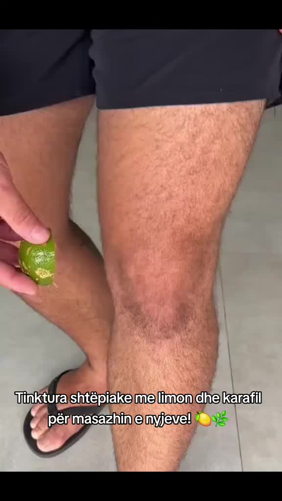 @Fakte Sh&euml;ndet&euml;sore