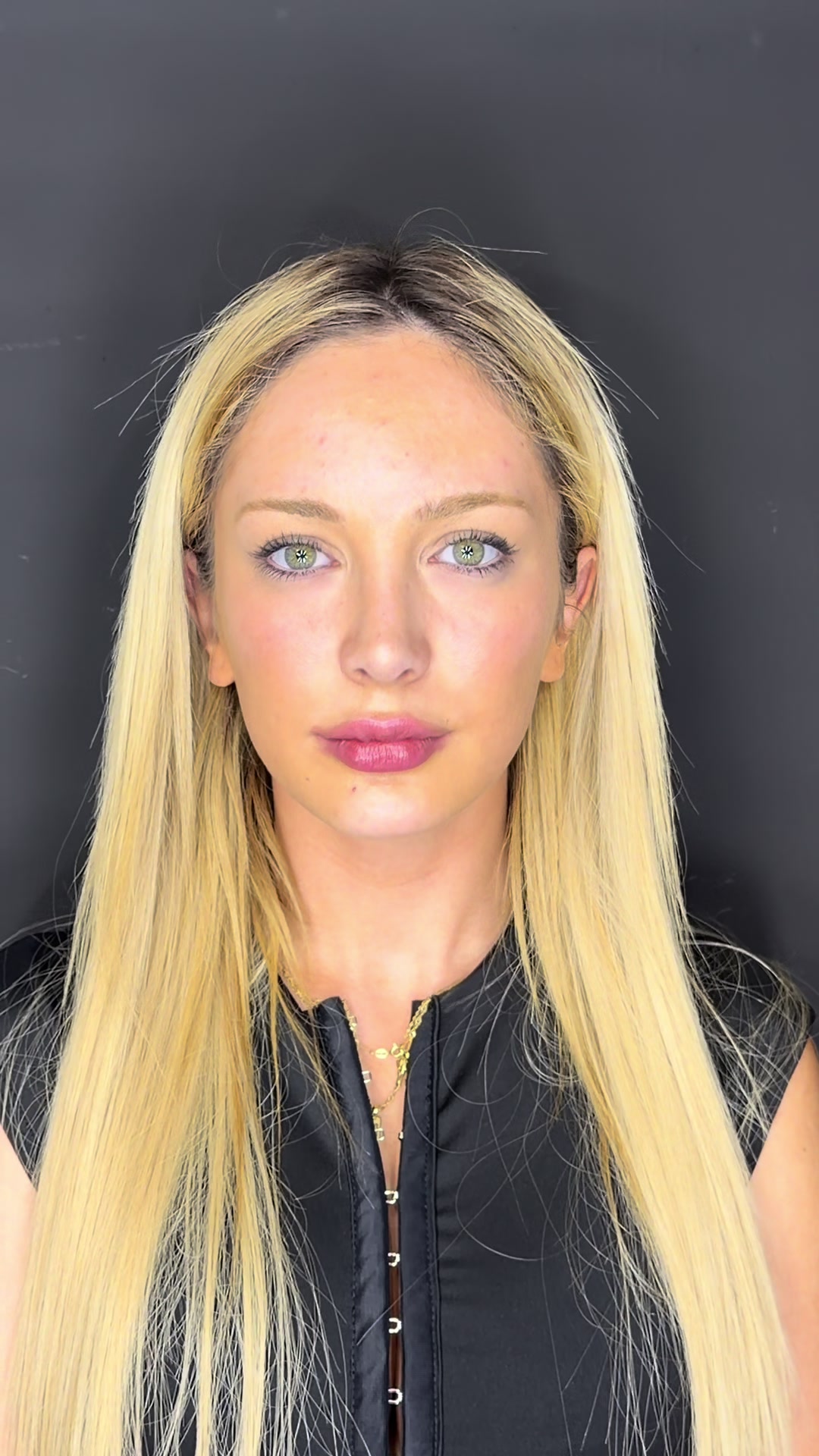 @drgarone.rinoplastia