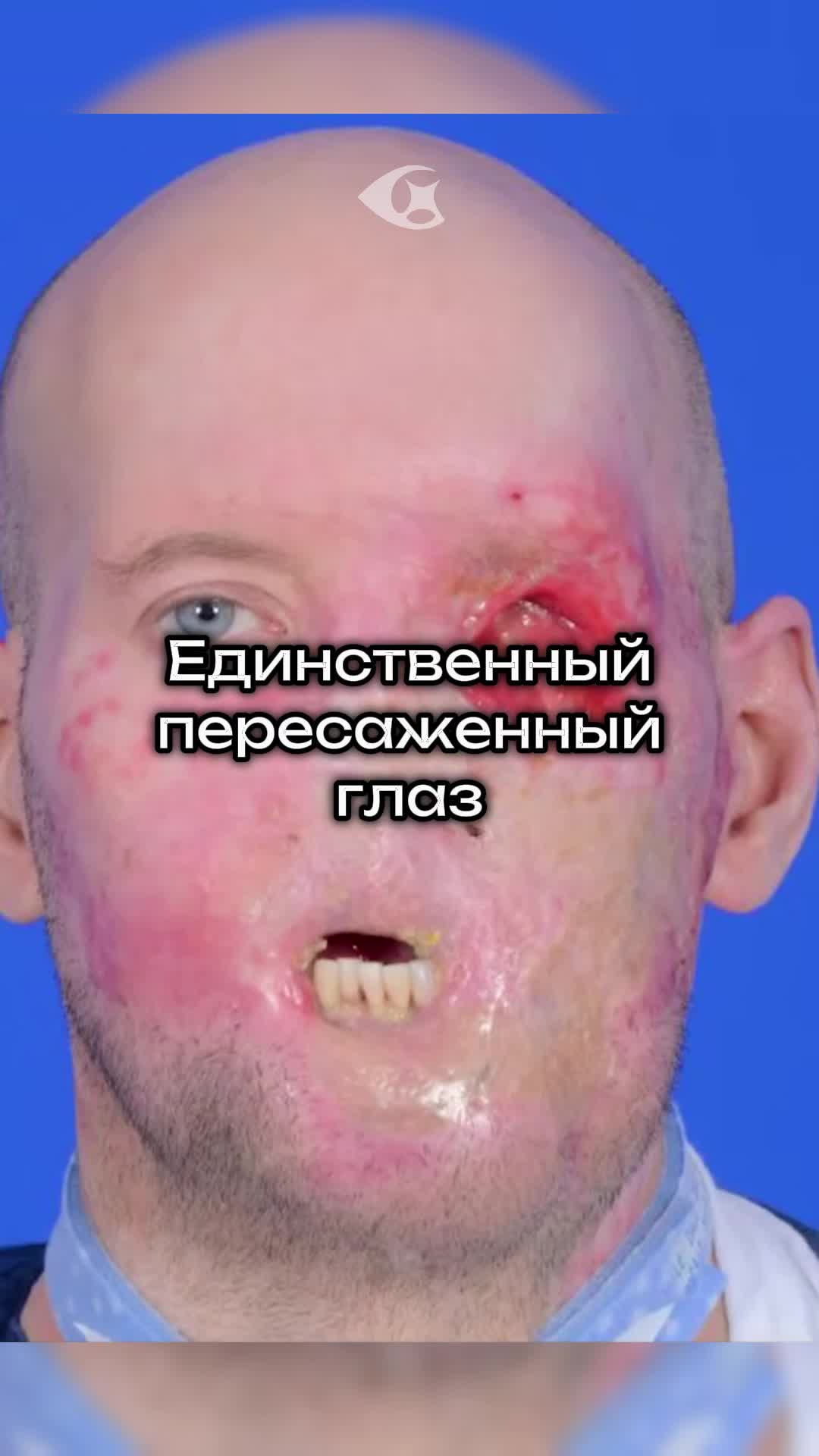 @Curiosity vision