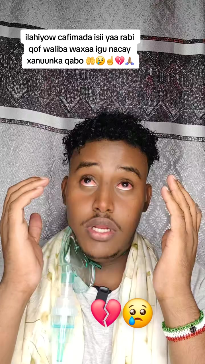 @Wiilka Xanuunka Lagu Nacay 😭