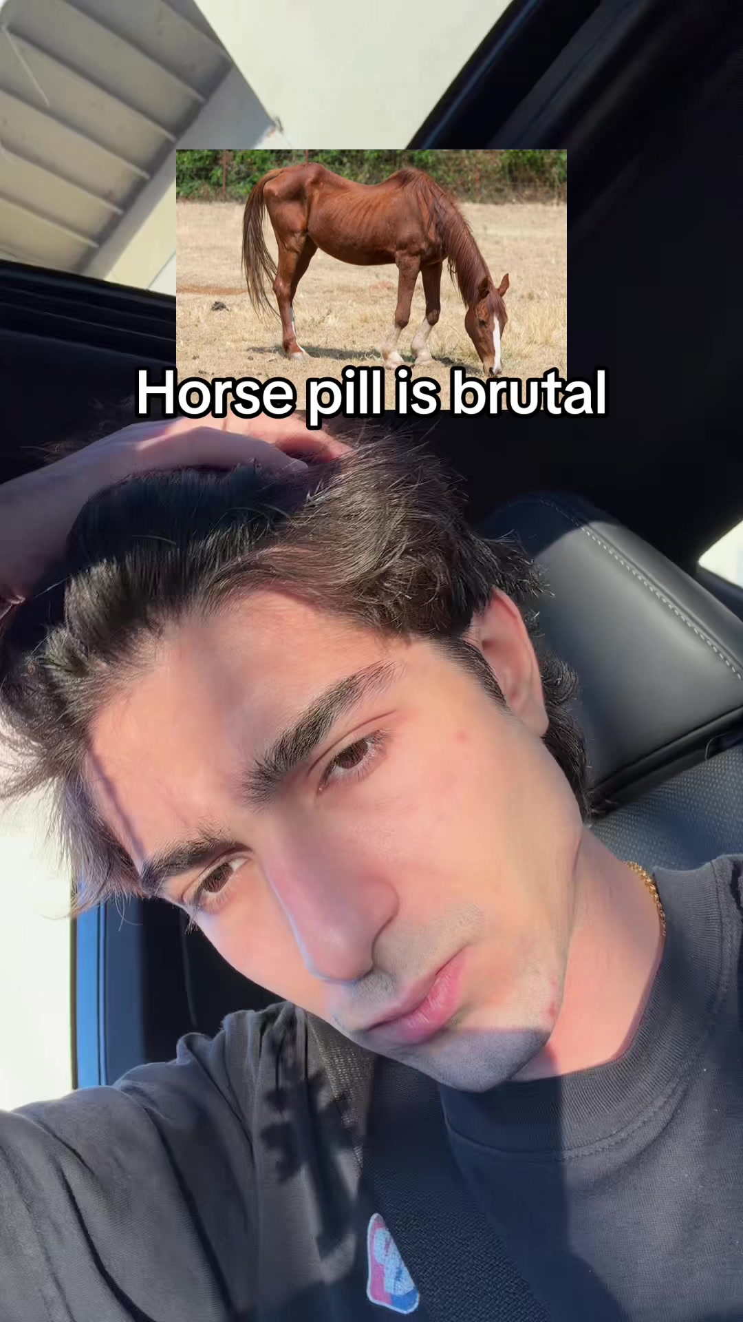 @XN