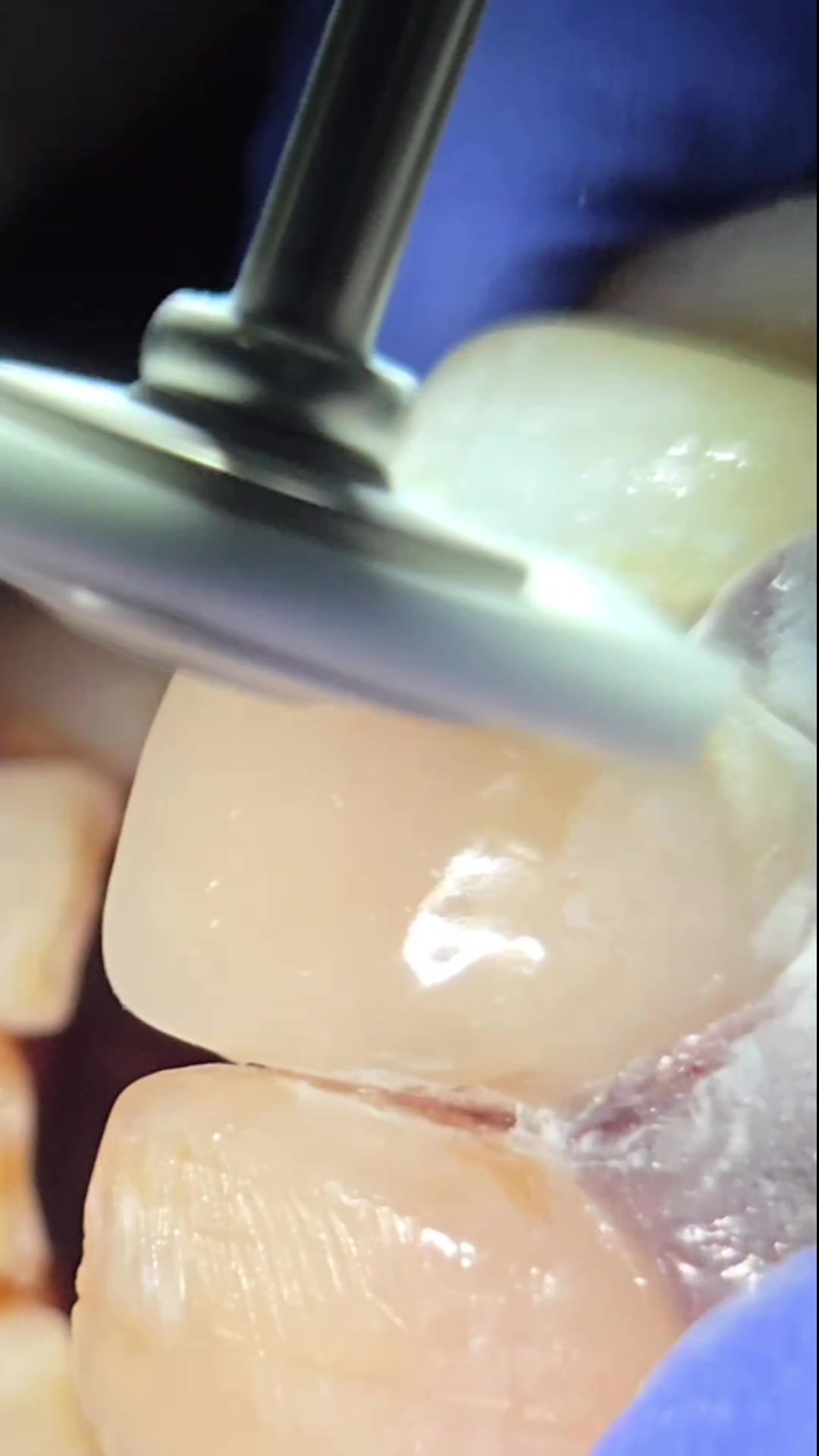 @Catford Dental