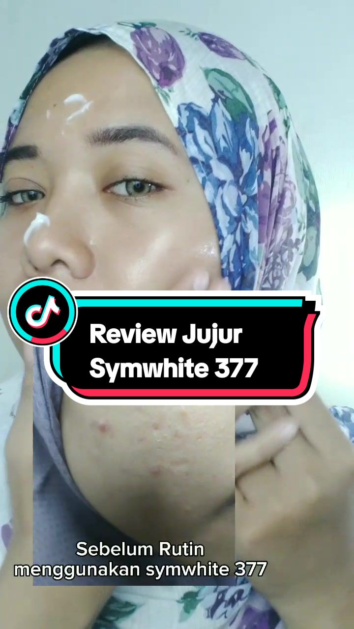 @windap_27