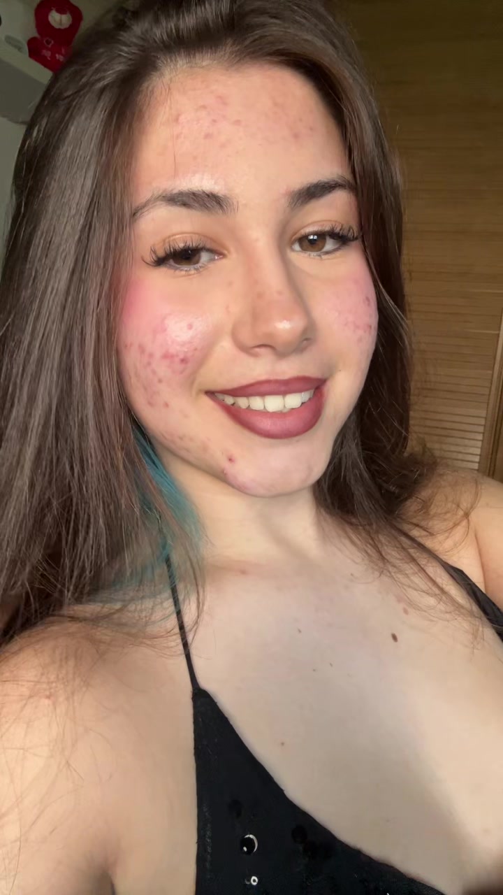 @🕷️