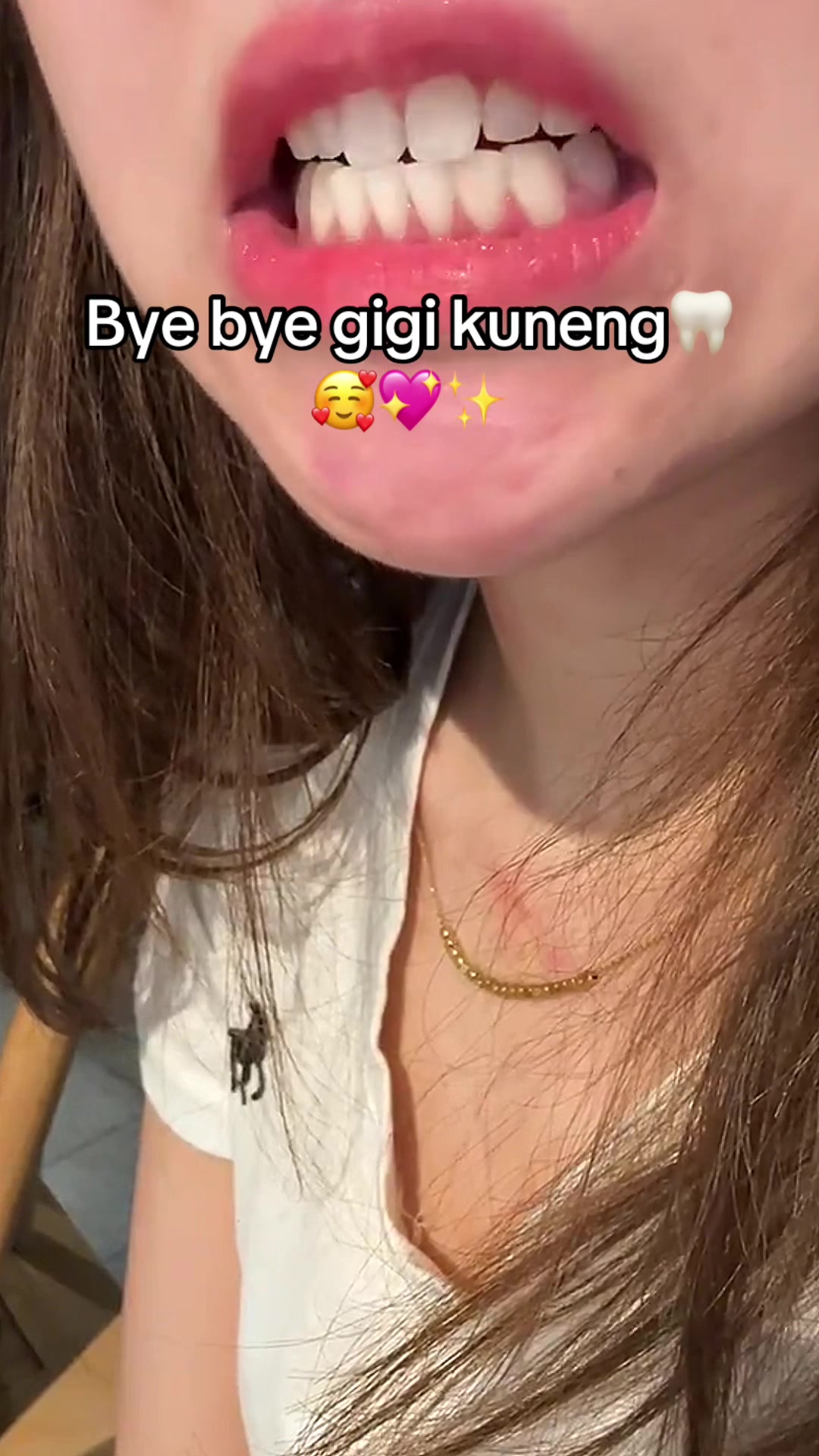 @Gigi Putih Berkilau🦷✨