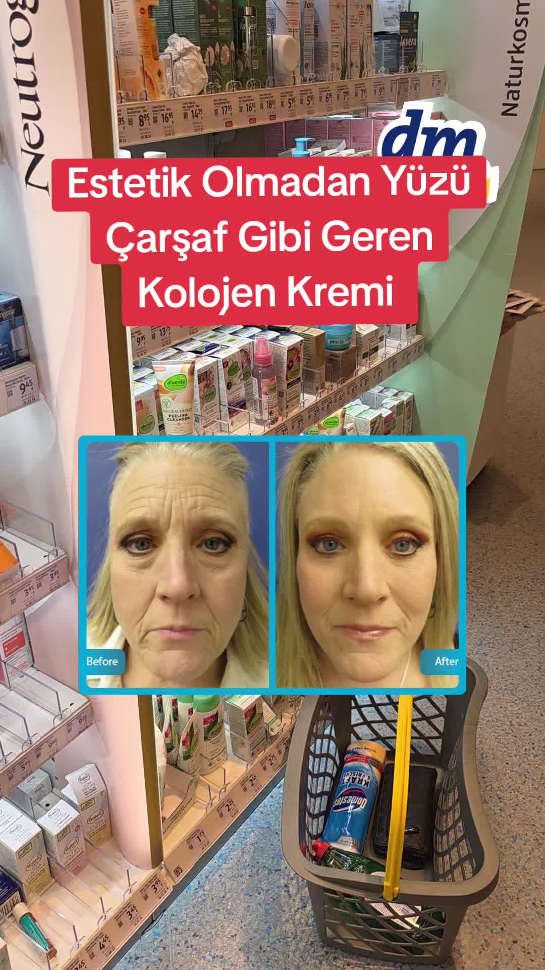 @Gurbetana27