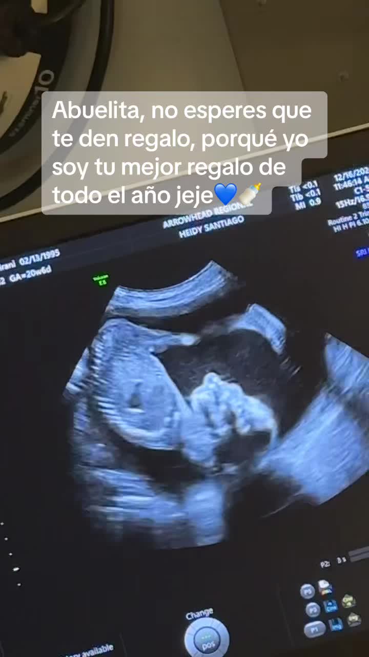 @Nani🖤